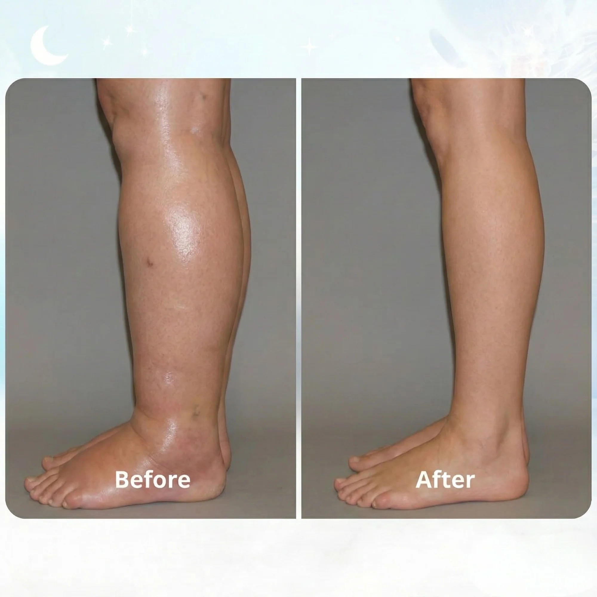 Legs EMS Stimulator
